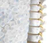 Poliuretano termoplástico aplicado en la medicina moderna FQC