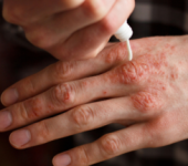 El cuidado de la barrera cutánea con productos y activos FQC