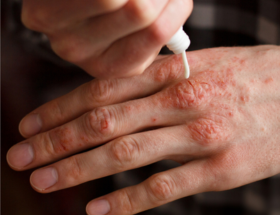 El cuidado de la barrera cutánea con productos y activos FQC